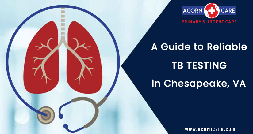 tb testing near me